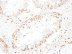 ASCC3L1 Antibody, Novus Biologicals 0.1mg; Unlabeled:Antibodies, Polyclonal